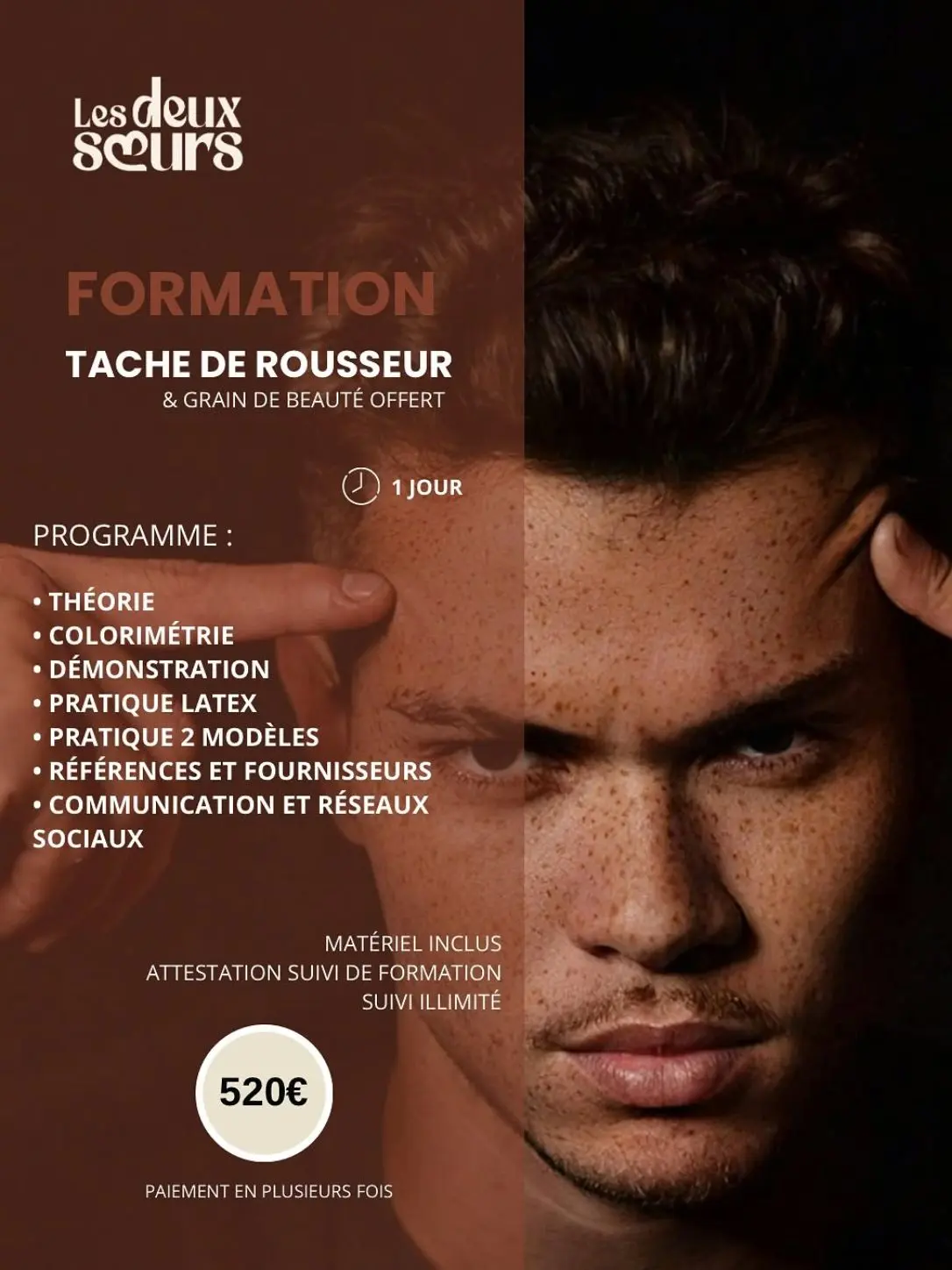 Formation taches de rousseur semi-permanent